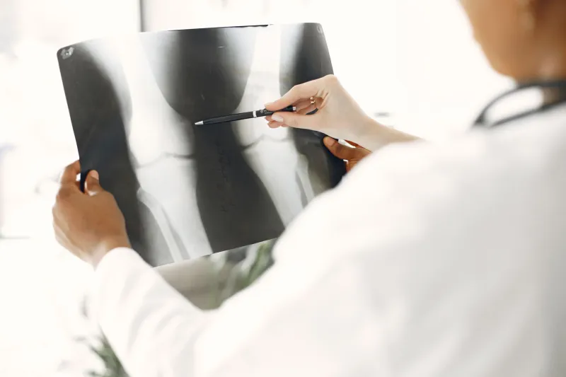 Joint Safety Signals: A Plain-Language Walkthrough of the Tanezumab Phase III Program